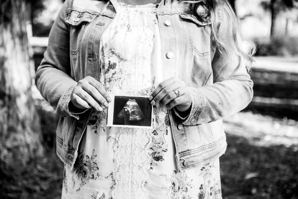 Life Begins at&nbsp;Conception